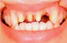 ttl-implant-img09.jpg